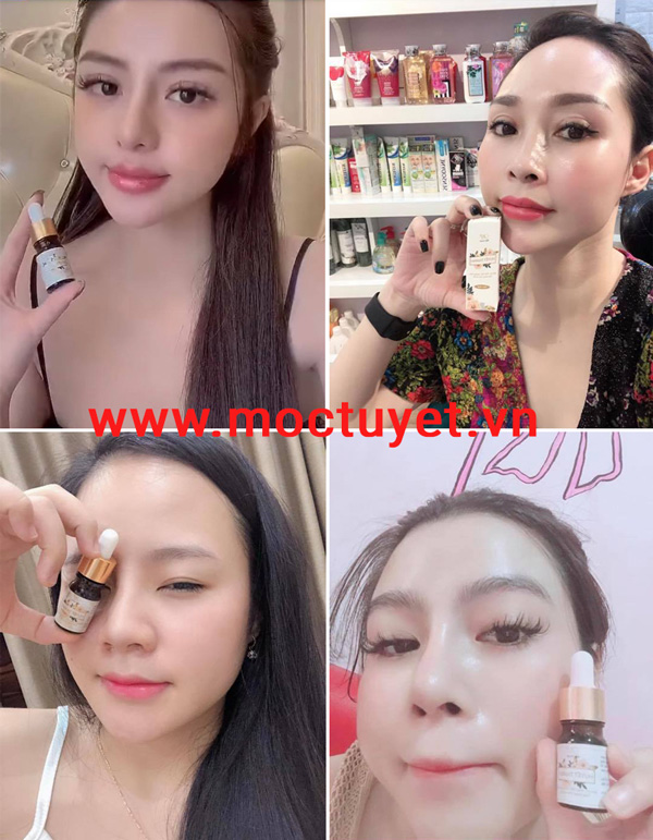 khách hàng huyết thanh mộc tuyết
